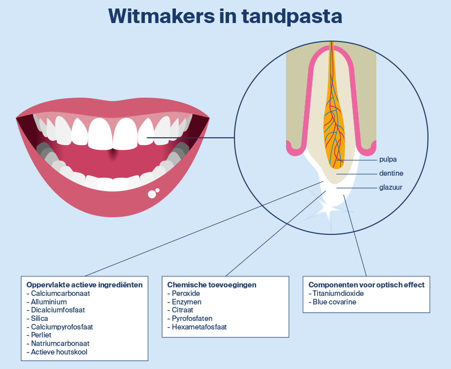 Infographics voor het Nederlands Tijdschrift voor Tandheelkunde